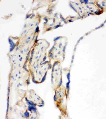 2 - Anti-mtTFA Antibody ABO11239