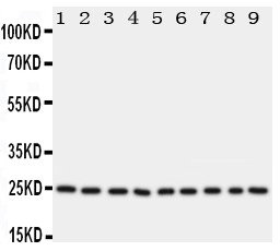 1 - Anti-mtTFA Antibody ABO11239