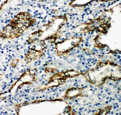 2 - Anti-Aquaporin 4 Antibody ABO11240