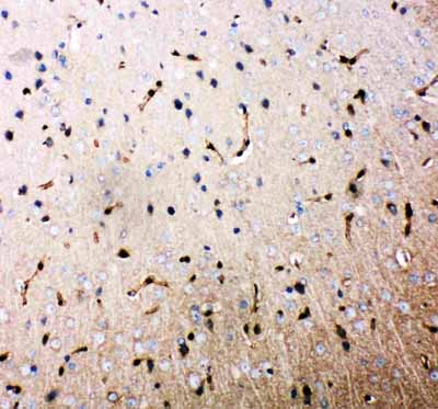 2 - Anti-Aquaporin 4 Antibody ABO11240