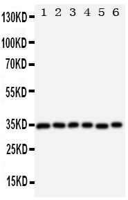 1 - Anti-Aquaporin 4 Antibody ABO11240