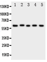 1 - Anti-ASIC3 Antibody ABO11241