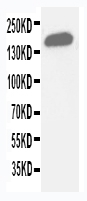 1 - Anti-Gli2 Antibody ABO11244
