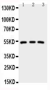 1 - Anti-IRAK4 Antibody ABO11245