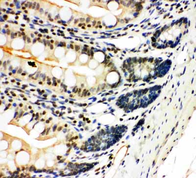 2 - Anti-NFkB p100/p52 Antibody ABO11250