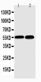 1 - Anti-NFkB p100/p52 Antibody ABO11250