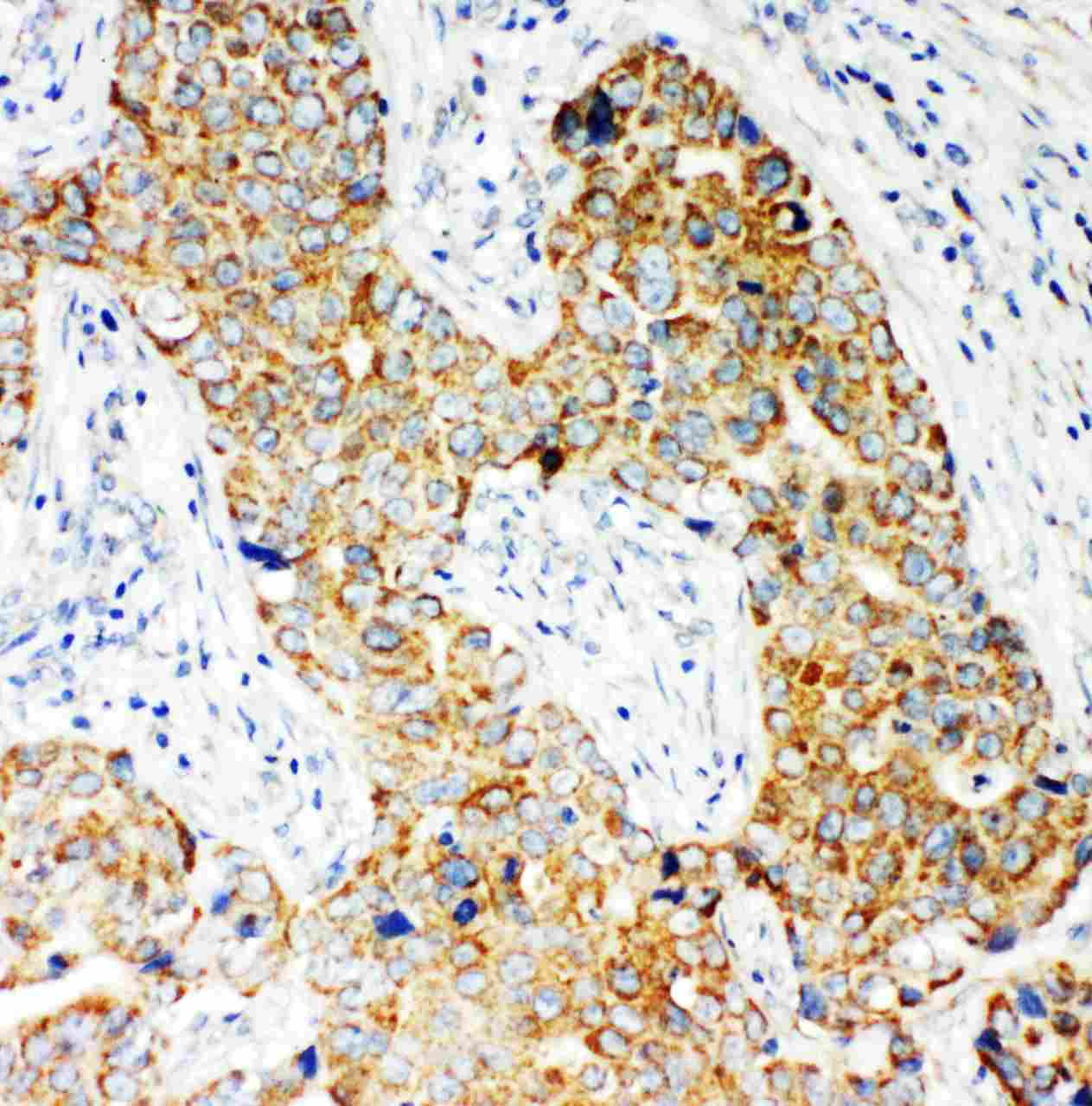 2 - Anti-NOX5 Antibody ABO11252