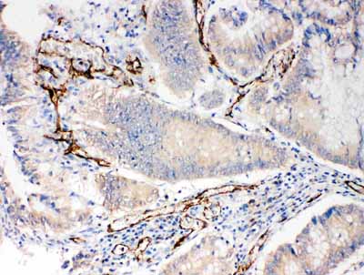 2 - Anti-PECAM-1/CD31 Antibody ABO11256