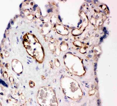 2 - Anti-PECAM-1/CD31 Antibody ABO11256