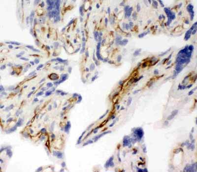 2 - Anti-PECAM-1/CD31 Antibody ABO11256