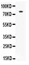 1 - Anti-PECAM-1/CD31 Antibody ABO11256