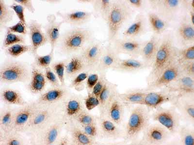 8 - Anti-REA Antibody ABO11257