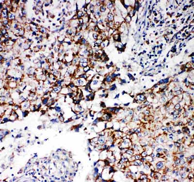 2 - Anti-REA Antibody ABO11257