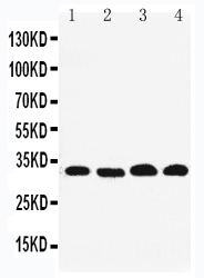 1 - Anti-REA Antibody ABO11257