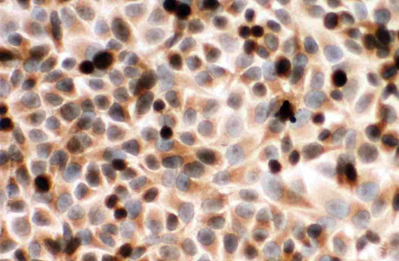 8 - Anti-POR Antibody ABO11258