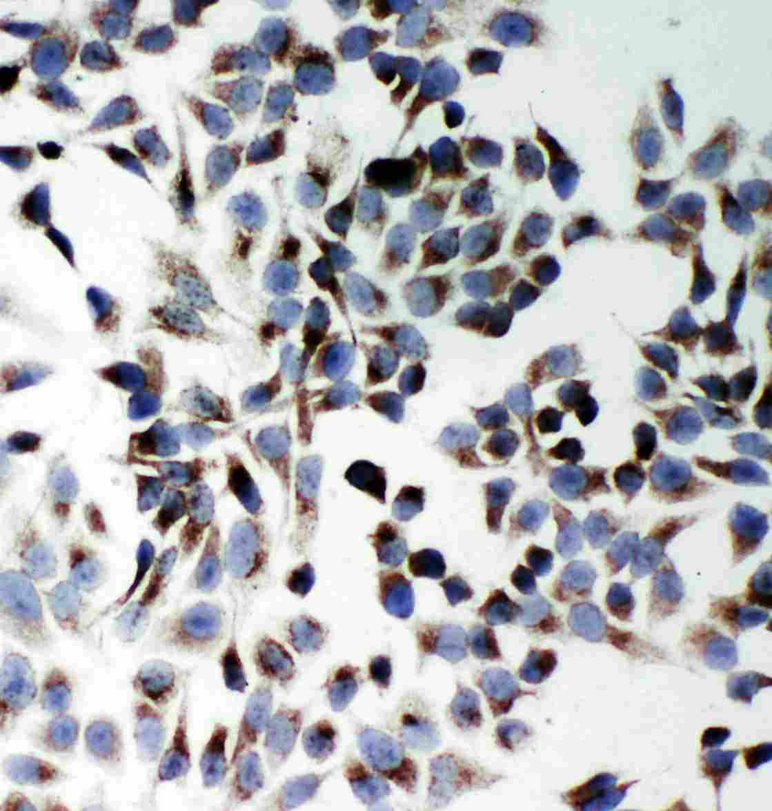 8 - Anti-SQSTM1/p62 Antibody ABO11261