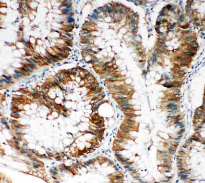 2 - Anti-SQSTM1/p62 Antibody ABO11261