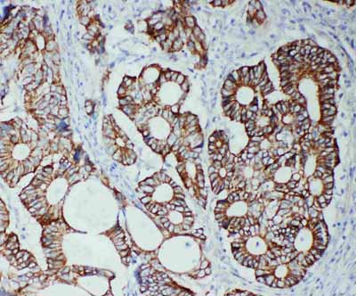 2 - Anti-TJP2 Antibody ABO11263