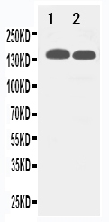 1 - Anti-TJP2 Antibody ABO11263
