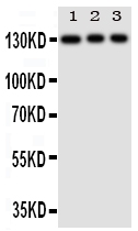 1 - Anti-TLR10 Antibody ABO11264
