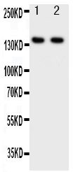 1 - Anti-ZEB2 Antibody ABO11265