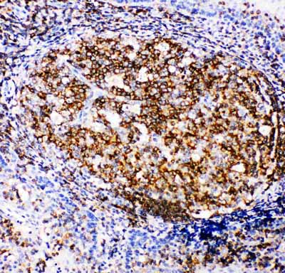 2 - Anti-RIAM Antibody ABO11266
