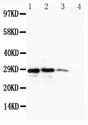 1 - Anti-CUEDC2 Antibody ABO11269