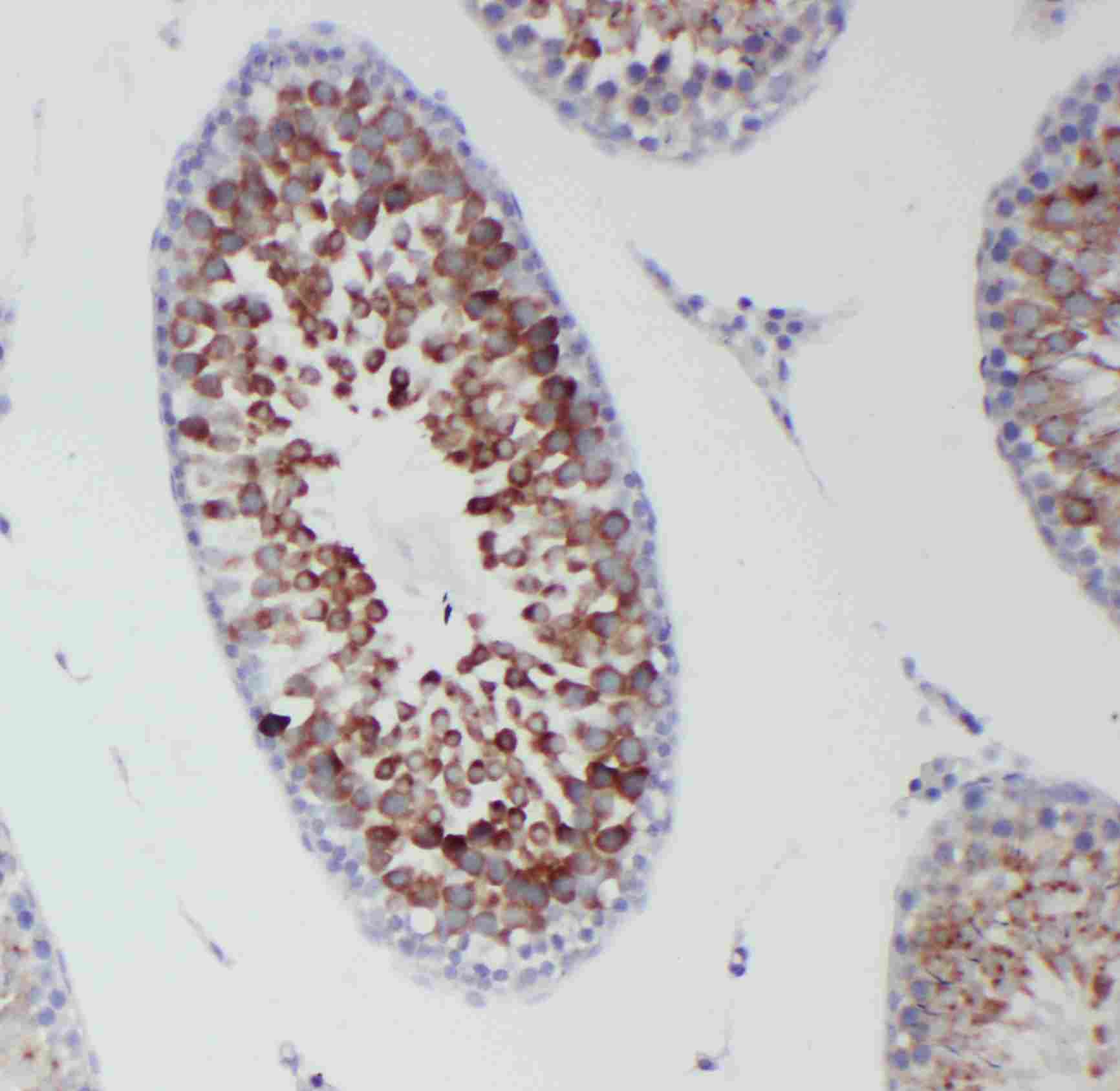 2 - Anti-DDX4/MVH Antibody ABO11270