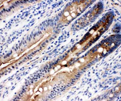 2 - Anti-DDX4/MVH Antibody ABO11270