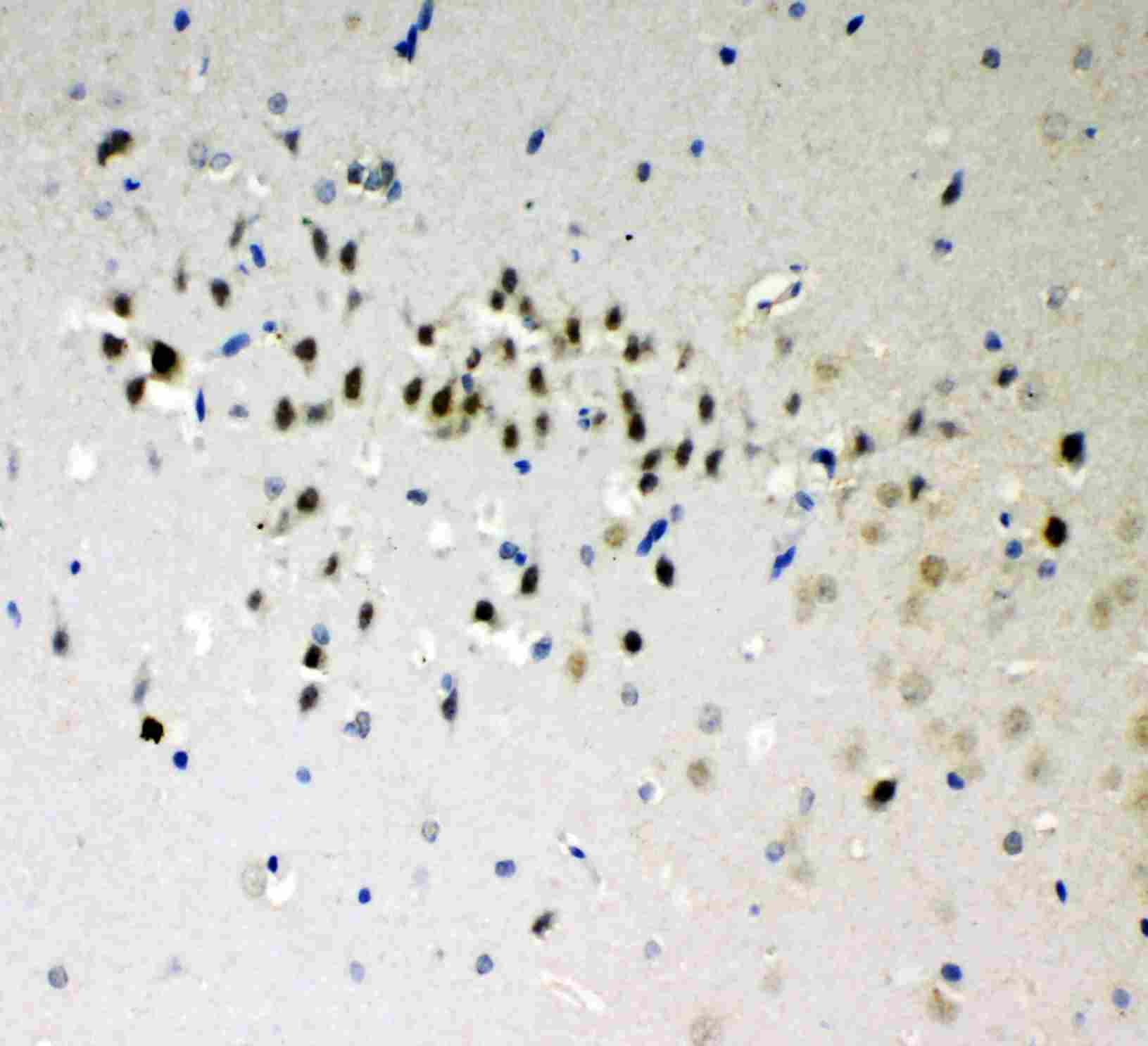 2 - Anti-DDX5 Antibody ABO11271