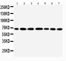 1 - Anti-DDX5 Antibody ABO11271