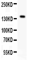 1 - Anti-VEGFR1/FLT1 Antibody ABO11273