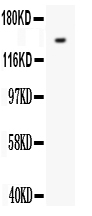 1 - Anti-VEGFR1/FLT1 Antibody ABO11274