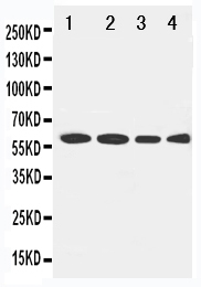 1 - Anti-LCAT Antibody ABO11275