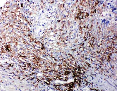 2 - Anti-LTBR Antibody ABO11276
