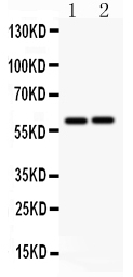 1 - Anti-LTBR Antibody ABO11276
