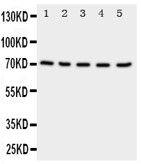 1 - Anti-Neuregulin-1 Antibody ABO11277