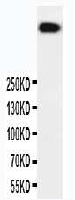 1 - Anti-DNA PKcs Antibody ABO11278