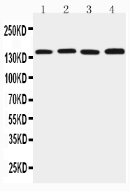 1 - Anti-TJP2 Antibody ABO11279