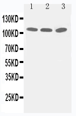 1 - Anti-Zonula Occludens Protein 3 Antibody ABO11280