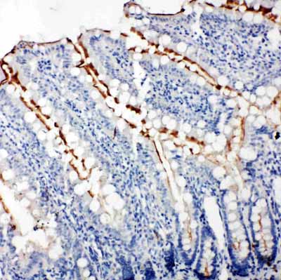 2 - Anti-Zonula Occludens Protein 3 Antibody ABO11281