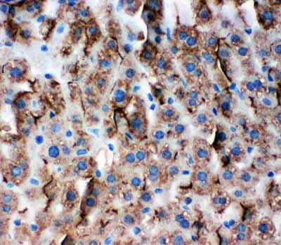 2 - Anti-Zonula Occludens Protein 3 Antibody ABO11281