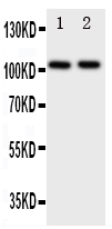 1 - Anti-Zonula Occludens Protein 3 Antibody ABO11281