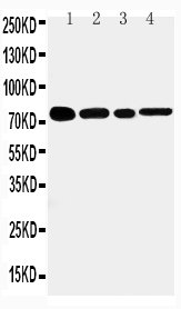 1 - Anti-sTNFsR II Antibody ABO11282