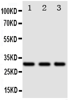 1 - Anti-DR4 Antibody ABO11283