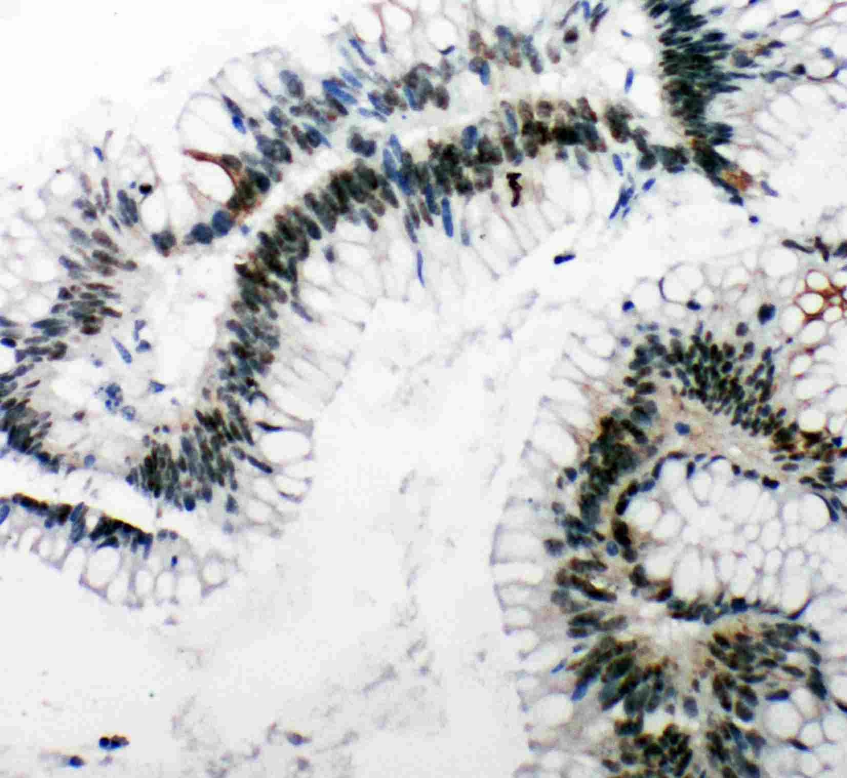 2 - Anti-53BP1 Antibody ABO11284