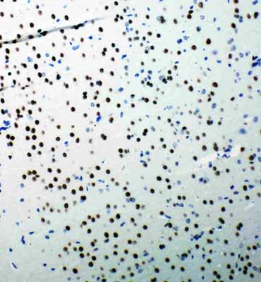 2 - Anti-53BP1 Antibody ABO11284