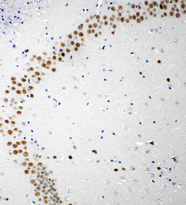 2 - Anti-53BP1 Antibody ABO11284