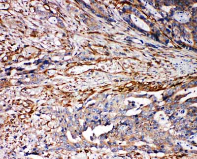 2 - Anti-VRL1 Antibody ABO11285