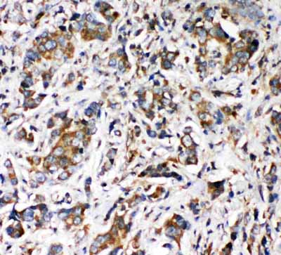 2 - Anti-VRL1 Antibody ABO11285